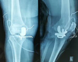 meriki-gonatos-koutsostathis-1