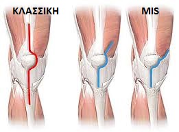 prospelasi-gonato-koutsostathis