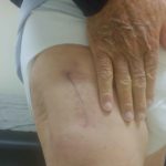 prosthia-prospelasi-koutsostathis